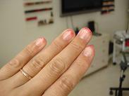 NAIL 003
