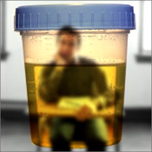 カルキ(漂白剤)を飲むアメリカの学生!?