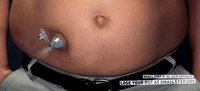 シャレにならないダイエットの広告