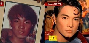 スーパーマンに憧れすぎて整形した男性の話題