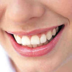 「口内炎」 を迅速に沈める方法