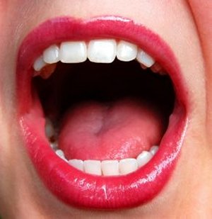 「口内炎」 を迅速に沈める方法