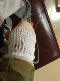 腸炎