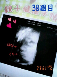 妊娠38週目。 2013/07/28 21:53:45