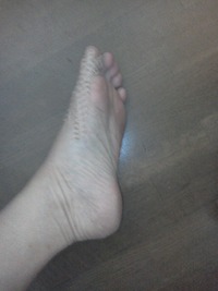 外反拇趾矯正テーピング講座 2012/09/26 07:40:49