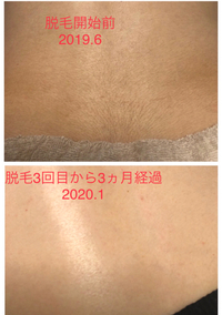 2月休業日のお知らせ☆脱毛before+after 2020/01/31 21:02:24