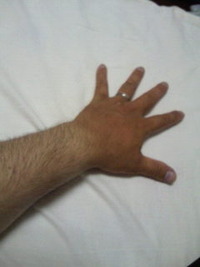 まるで手袋 2011/07/04 20:41:02