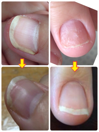 爪のお手入れ専門 オーガニックネイルケア ティンカーベル 健康な爪になるために大切なこと それは 正しいケアを続けること 宜野湾市オーガニックネイル認定サロン ティンカーベル