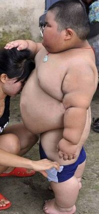 中国富裕層の超肥満体 3歳にして体重40kgの男の子