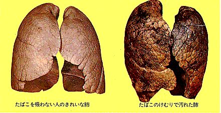 18日目