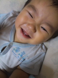 手足口病。 2011/07/30 07:38:54