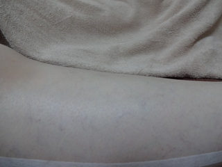 口コミ人気上昇中！！夏本番に備えてビッグキャンペーン全身脱毛！！つるつるのお肌でビキニ！！