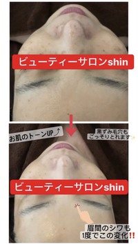 豊見城市人気エステサロン‼️豊見城市子連れOKエステサロン‼️豊見城市夜遅くまで営業エステサロン‼️