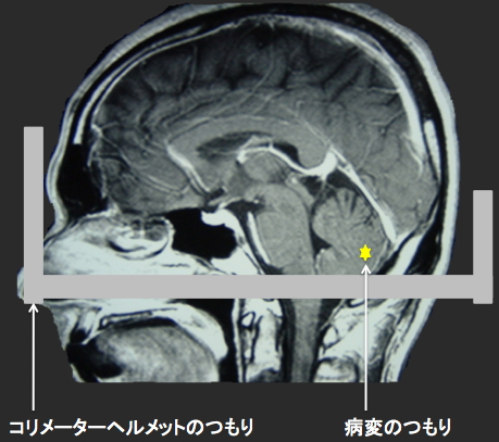 あたる！