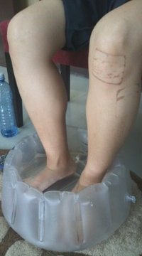 マラソンからその後