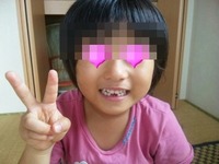 歯が〜 2012/08/08 21:33:25